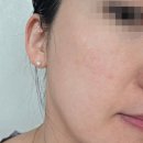 소금마을온열체험 | 모공팩 추천 토르홉 온열 소금팩 내돈내산 사용후기