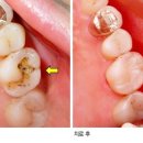 투명한치과 네이버블로그