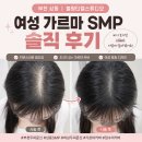 가르마 | 부천 탈모관리 상동역 두피문신 블랑티엘스튜디오 여성 가르마 SMP 후기