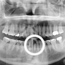동탄가온치과의원 이미지