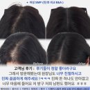 디에이헤어 - 은평구 진흥로 267-16 | 디에이헤어