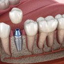 생각나무치과의원 이미지