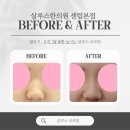 한실한의원 | 코프팅 전용실,1줄의 두께는?