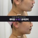 JM메디칼 | 황금동에스테틱은 에이원뷰티