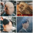 젠틀모 | 수원 가발에서 젠틀모 방문 후기 영상 ( 가발 책임지는 업체 )