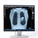 백정형외과의원 | 으아악! 내 무릎 왜 이러냐구.. 찐 경험담으로 풀어보는 수원 정형외과 탐방기