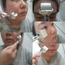 (주)디엔컴퍼니 | [맘스홀릭지후맘/(주)디엔컴퍼니] 이지듀 MTS 홈케어면 집에서도 간편하게 피부관리가 가능해요