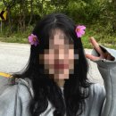 맥스웰의원 | 맥스웰의원 여의도 여성탈모치료 (7~12주차) 진전 정도 내돈내산