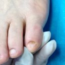 레푸스 앤 쓰담네일 이미지