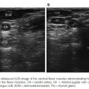 19차 뉴렉 정기모임 관련 논문읽기 - The Relevance of Proprioception to Chronic Neck Pain:Muscle Size, Endurance, Characteristics, and Proprioception 이미지