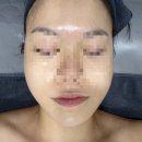 허브PC방(나운점) | 군산피부관리,군산나운동피부관리, 모공디톡스 “올가드림뷰티 나운한울점“
