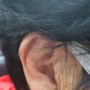 시그니아독일보청기대구북구센터 이미지