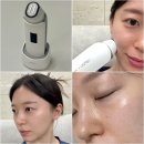 시크릿 | 고주파 뷰티디바이스 바나브 시크릿 코드 홈케어기기 후기