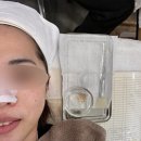 유즈뷰티 | 유즈뷰티에서 더마플래닝 두번째 받은 후기