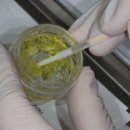 1미리치과의원 | 부천중동피부과 환자분, 피부색에 비해 치아가 너무 노래 보여요.