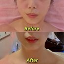 유마인&헤어 | 송파에스테틱샵 “인하에스테틱”💖 AI 바디케어로 다이어트+피로케어 동시에! 유마인 바디젯 AI 후기✨