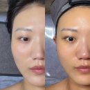 마포구청역 2번출구 | 마포구청역 피부관리 웨딩케어, 신부관리의 명가 이모아 에스테틱 솔직후기 / 성산동 피부관리