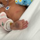 은평베스트성모내과의원 | 은평성모병원 제왕절개 후기 | 응급제왕, 1인실 입원, 척추마취 부작용, 38주차 출산 (feat. 배재영...