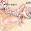 [후기] 5.19 인공와우 축제를 참석하고 나서 이미지