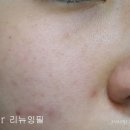 아티스트리 미용실 | 아티스트리 스킨 배리어 프로텍션으로 촉촉 매끄러운 피부결로 관리!