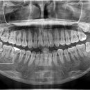 더바른윤치과의원 이미지