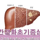 간경화 초기증상 말기증상 및 치료 (간경변, 간섬유화, 알콜성, 복수) 이미지