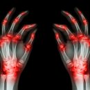 참좋은 마취통증의학과의원 이미지