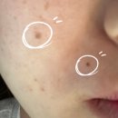 오라클피부과의원(화곡점) | 라르떼의원 점, 잡티제거 화곡가성비피부과 내돈내산 후기