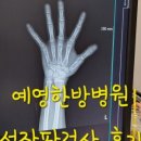 티엘씨분당의원 네이버블로그