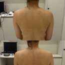 노바의원 | 평택피부관리 고덕 도도에스테틱 등관리 테라노바 추천