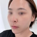 리포즈에스테틱 | 운정 야당 피부관리 비타민 미백관리 파주 리포즈에스테틱 후기