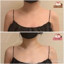 올마디한의원 | 골드테라피 웨딩관리 통증제로 체형리셋 관리 2회차