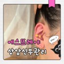 에스뜨레야 | 상암동 피부관리 에스뜨레야 웨딩 촬영 전 필수 관리 후기