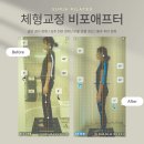 필라테스수피아 | [도담동 수피아필라테스] 3개월 만에 달라진 체형교정 후기