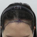 압구정맘모스헤어라인의원 이미지