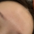 303-운정-303 | 파주 운정 야당역 좁쌀여드름 + 문제성피부전문 익스테틱 내돈내산 솔직후기!