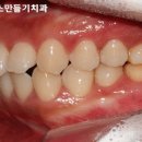 오승훈치과의원 네이버블로그