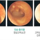 소리코이비인후과 네이버블로그