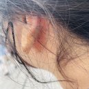 서울티에프이비인후과의원 이미지