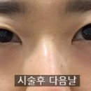 인디언짐 이미지