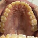 성심의원 | 구로역 성심치과 스케일링 후기