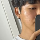 김해 신상 피부관리 미용 맛집 에이블러의원, 리쥬란HB 힐러 후기