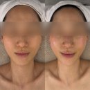 강서 탑 골프존 | 마곡발산 움트다에스테틱 | 강서구 신부 관리 경락 맛집 내돈내산 추천