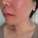 좋은친구화장품 | 민감성 숙성토너에센스 안동오곡화장품 숙성 안동오곡토너 리얼후기