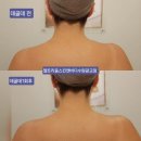 토탈메디케어 | [광교] 수원 광교피부관리 엘트리움스킨앤바디에서 피부미백과 탄력까지 : 엘트리움 스킨앤바디