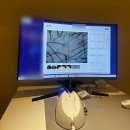 플라즈마 힐링센터 | 잠실탈모 고민될 때 두피정밀진단 받고 온 후기 | 모바이오 송파문정점 잠실두피관리