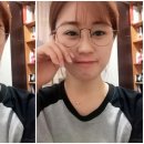 매몰 인라인/아웃라인 쌍꺼풀 수술 후기(노원 이지성형외과)