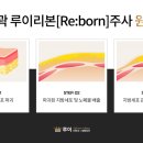 루이피부과의원 네이버블로그