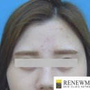 리뉴미피부과의원 이미지