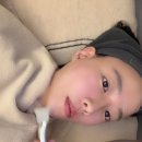 청담피부과 티타늄리프팅 한달 차 후기(이중턱, 팔자주름)